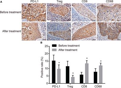 PD-1/PD-L1 Correlates With the Efficacy of the Treatment of Concurrent Chemoradiotherapy in Cervical Cancer